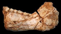 human jaw bone