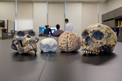 2 different skull and brain sizes