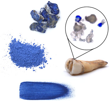 Lapis pigment and tooth