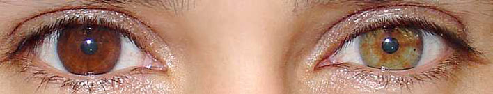 Eyes from a woman with one brown eye and one hazel eye